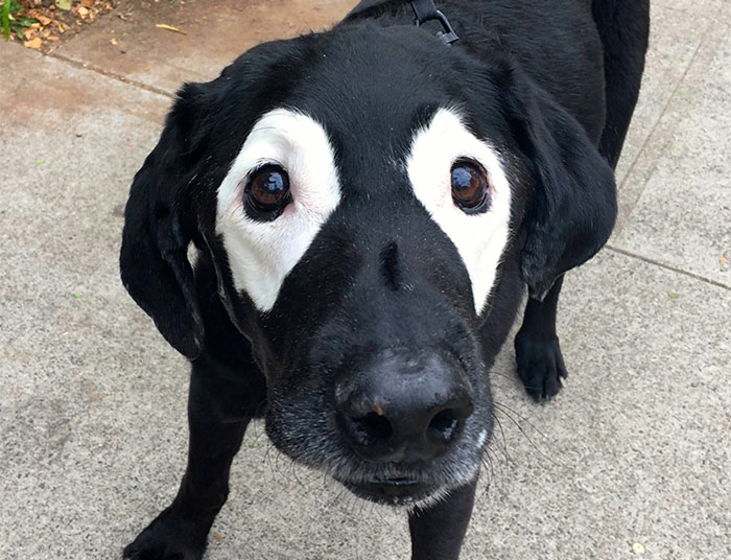 2-vitiligo1-731w