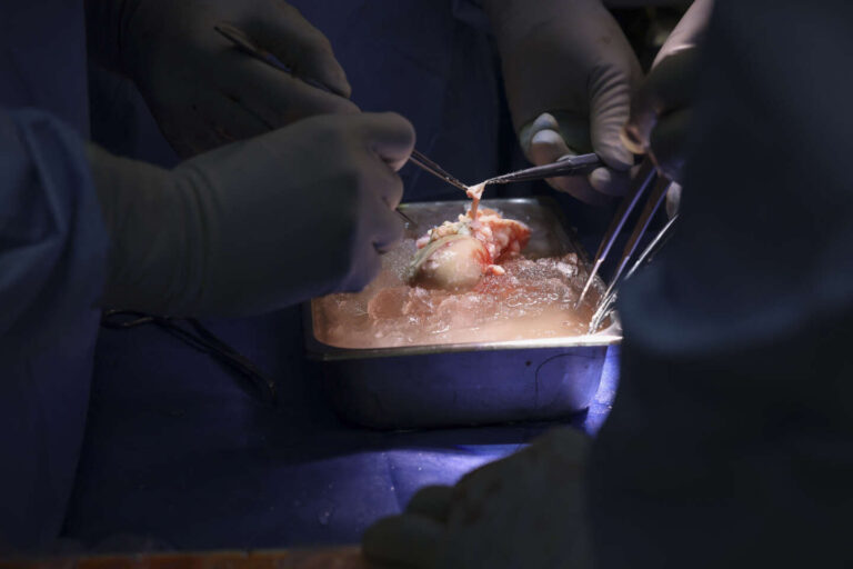 US-HEALTH-TRANSPLANT-KIDNEY