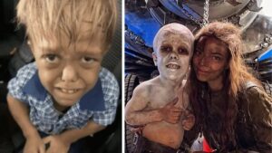 Adolescent harcelé enfant pour son nanisme décroche un rôle dans le prochain Mad Max