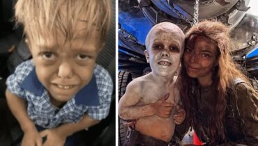 Adolescent harcelé enfant pour son nanisme décroche un rôle dans le prochain Mad Max