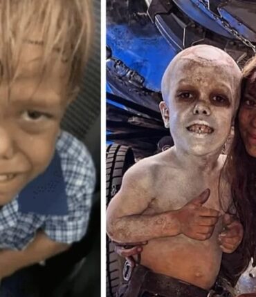 Adolescent harcelé enfant pour son nanisme décroche un rôle dans le prochain Mad Max