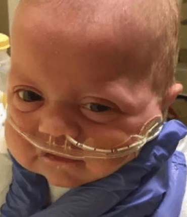 L’histoire incroyable de Tru Beare, née avec un poids d’à peine 500 grammes