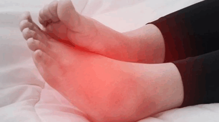 Pieds qui gonflent : quelles significations et quelles solutions ?