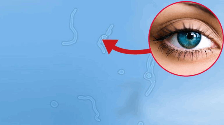 Pourquoi il vous arrive de voir des choses flottantes dans vos yeux !