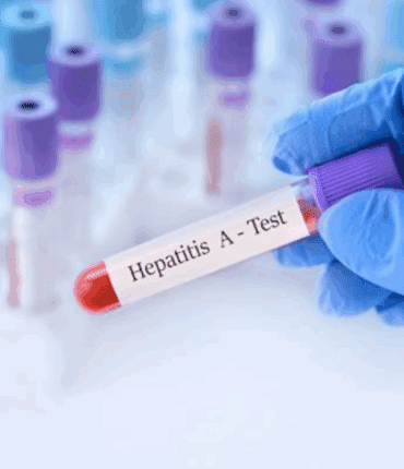 Hépatite A à Lyon : une flambée de +356 % des cas intrigue les autorités sanitaires