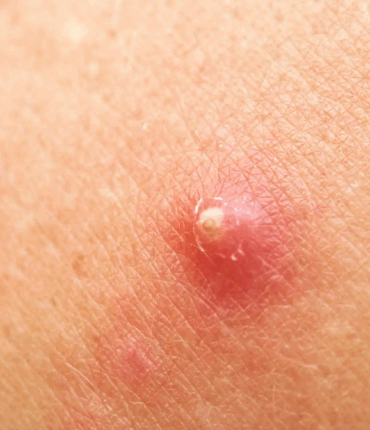 Ne touchez jamais à un bouton dans le « Triangle de la mort » – cette femme a fini paralysée