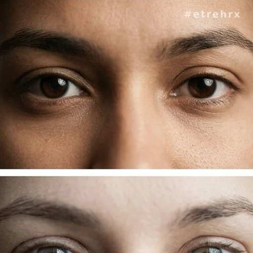 Gros plan sur des yeux marrons, couleur la plus répandue selon l'étude